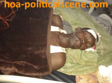 hoa-politicalscene.com - Human Rights in Sudan: Civil rights activist Salah Qamar in hospital suffering from injuries after being beaten by the security of the regime.